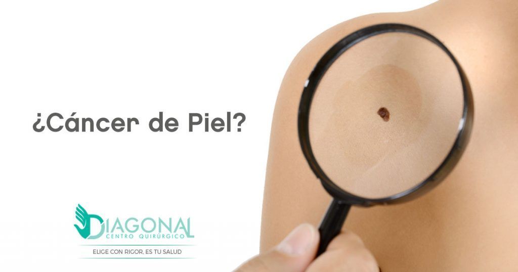Cáncer de Piel: Tratamientos | Diagonal CQ