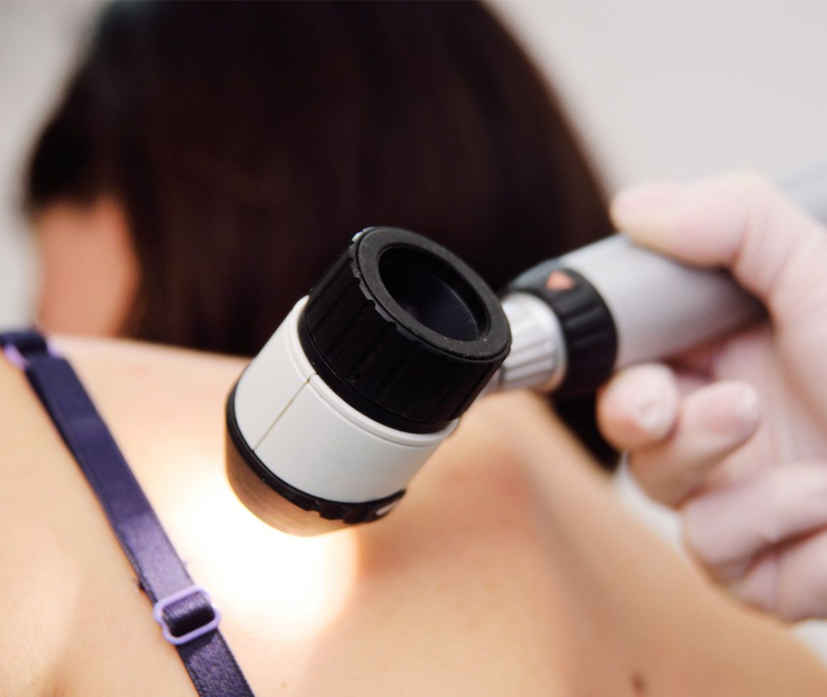 Heridas y quemaduras: guía médica | Diagonal CQ